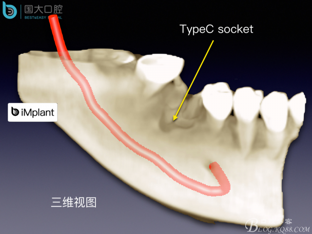 20160806124116_37585.jpeg 20160806124116_37585.jpeg