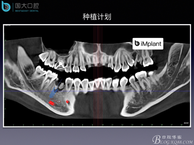 20160806124118_71266.jpeg 20160806124118_71266.jpeg