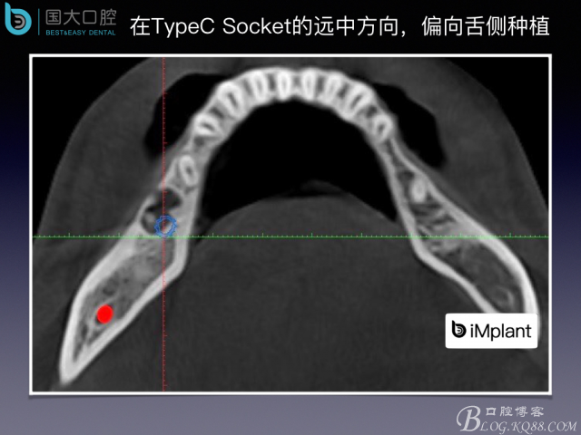 20160806124120_14213.jpeg 20160806124120_14213.jpeg