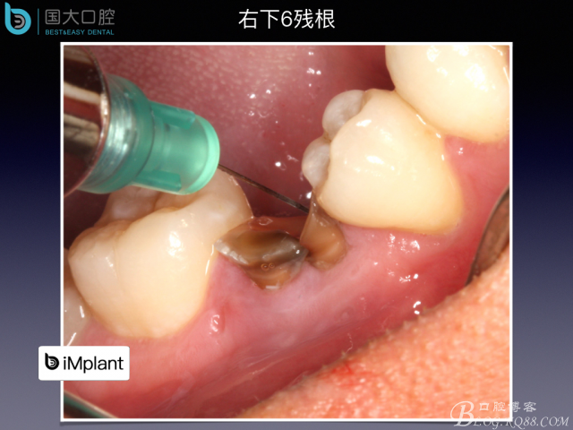 20160806124134_76912.jpeg 20160806124134_76912.jpeg