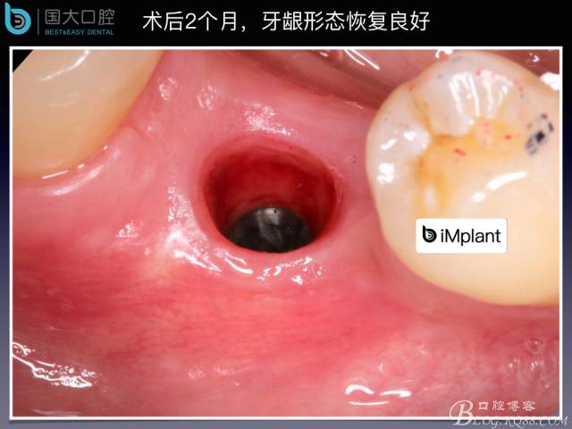 20160806124226_22067.jpeg 20160806124226_22067.jpeg