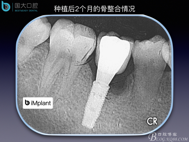 20160806124233_87607.jpeg 20160806124233_87607.jpeg