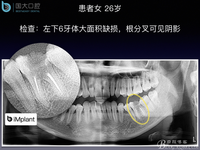 20161002181559_88280.jpeg 20161002181559_88280.jpeg