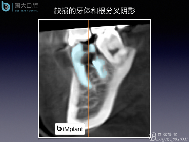 20161002181601_52146.jpeg 20161002181601_52146.jpeg