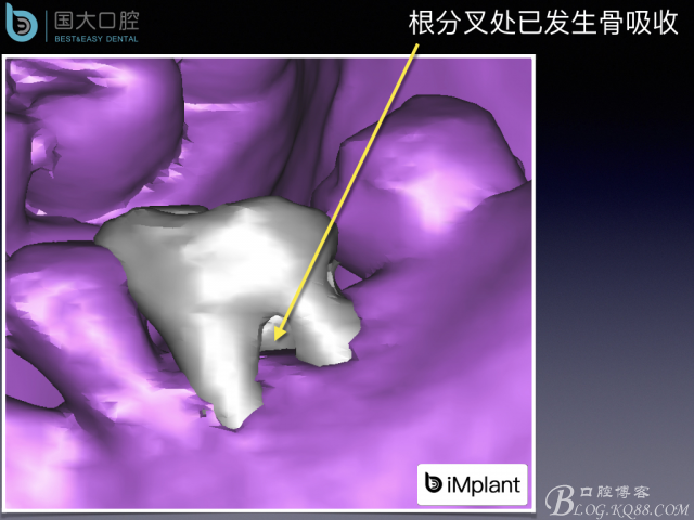 20161002181604_42127.jpeg 20161002181604_42127.jpeg