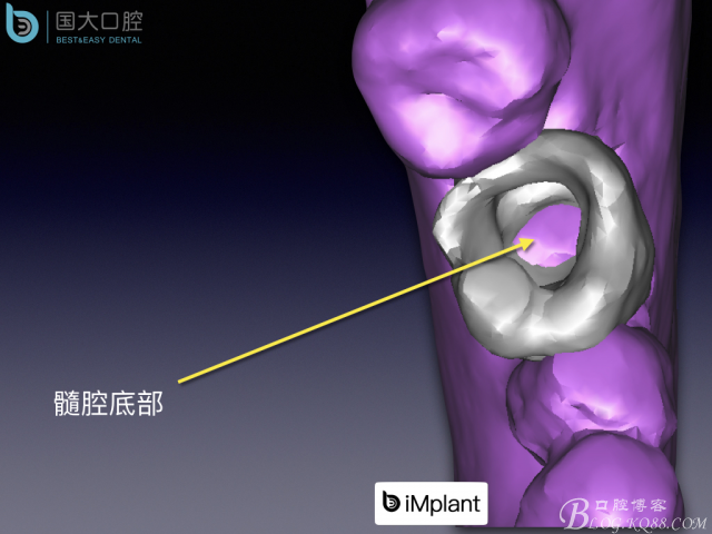 20161002181605_86023.jpeg 20161002181605_86023.jpeg