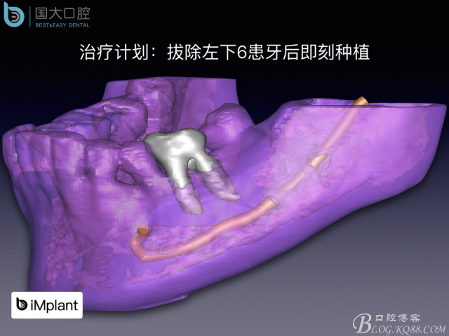 20161002181607_38463.jpeg 20161002181607_38463.jpeg