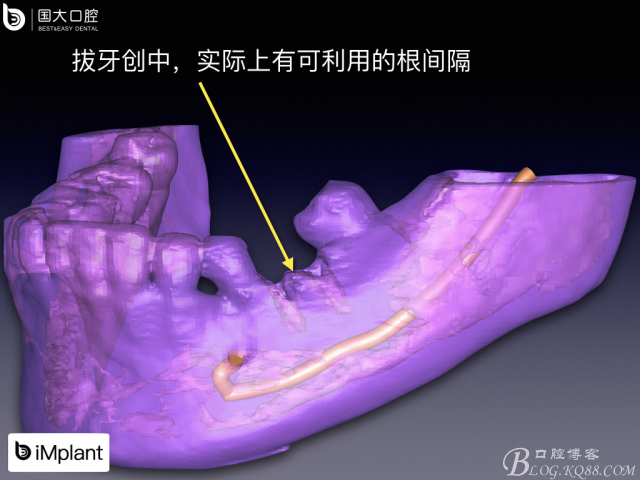 20161002181610_29014.jpeg 20161002181610_29014.jpeg