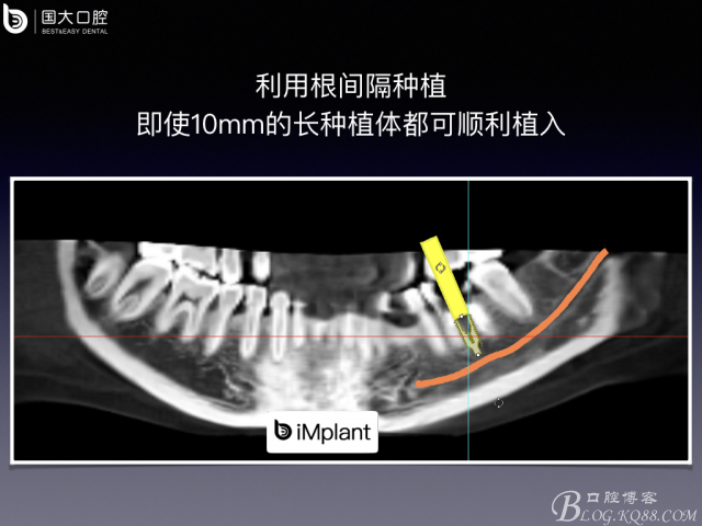 20161002181613_84156.jpeg 20161002181613_84156.jpeg