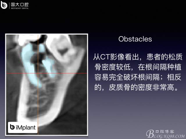 20161002181616_45490.jpeg 20161002181616_45490.jpeg