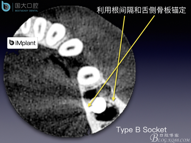 20161002181620_36405.jpeg 20161002181620_36405.jpeg