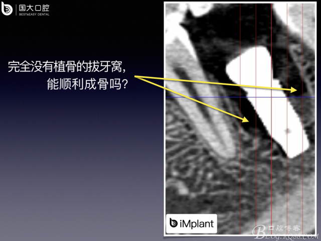 20161002181643_61376.jpeg 20161002181643_61376.jpeg