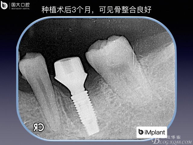 20161002181645_74565.jpeg 20161002181645_74565.jpeg