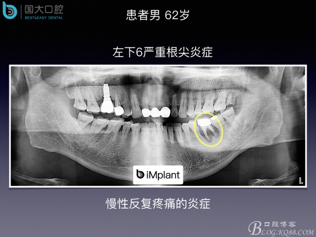 20160715154344_61331.jpeg 20160715154344_61331.jpeg