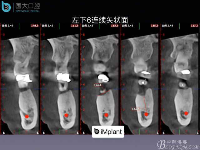 20160715154347_21106.jpeg 20160715154347_21106.jpeg