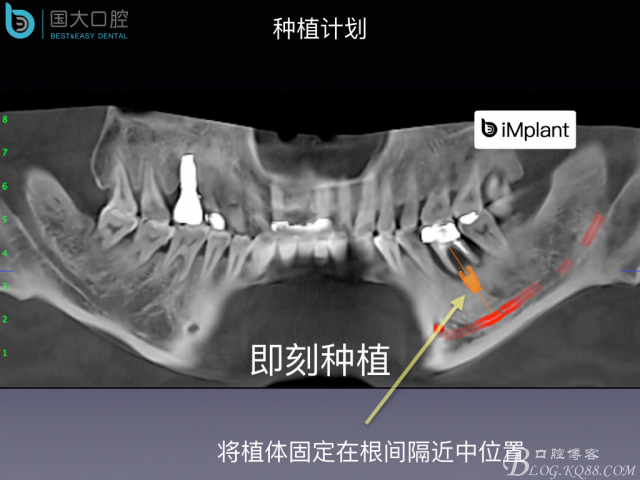 20160715154354_51076.jpeg 20160715154354_51076.jpeg
