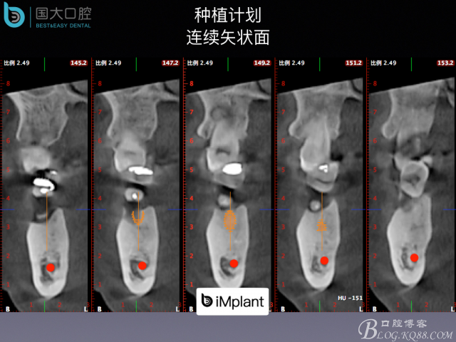 20160715154355_15281.jpeg 20160715154355_15281.jpeg