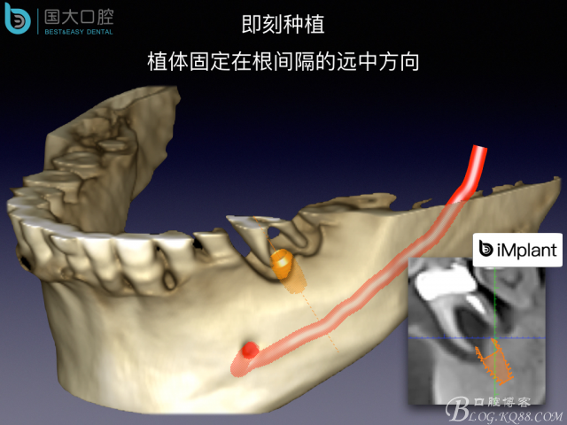 20160715154356_22306.jpeg 20160715154356_22306.jpeg