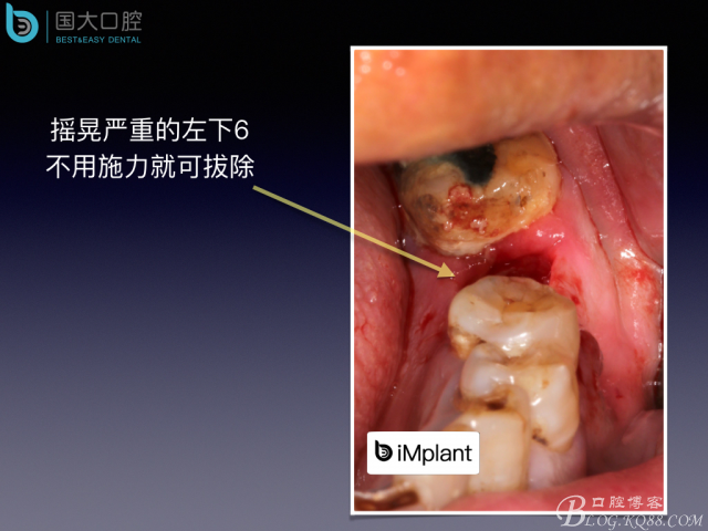 20160715154358_93757.jpeg 20160715154358_93757.jpeg