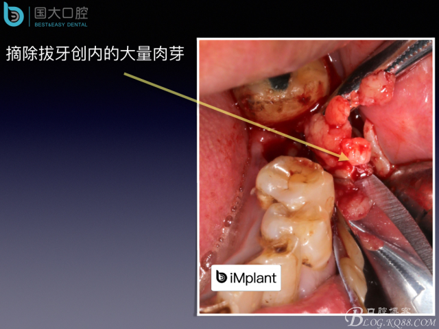 20160715154400_83807.jpeg 20160715154400_83807.jpeg