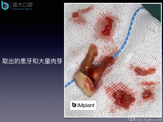 20160715154405_10930.jpeg 20160715154405_10930.jpeg