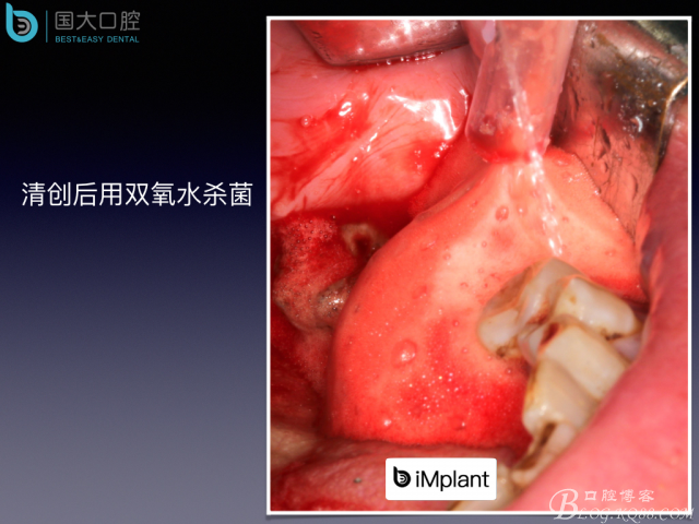 20160715154406_52369.jpeg 20160715154406_52369.jpeg