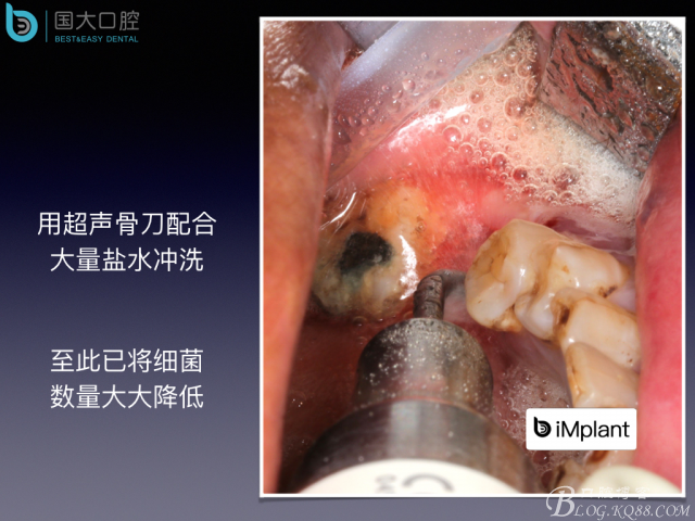 20160715154409_91378.jpeg 20160715154409_91378.jpeg