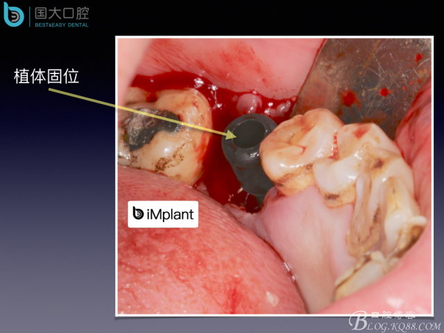 20160715154459_12116.jpeg 20160715154459_12116.jpeg