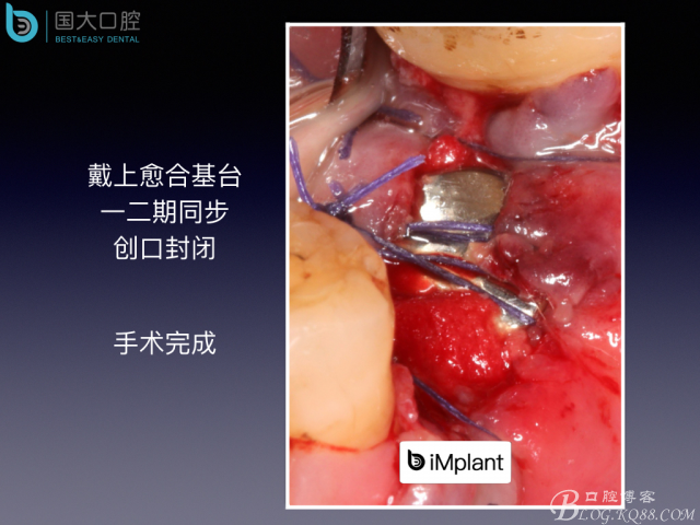 20160715154504_58385.jpeg 20160715154504_58385.jpeg