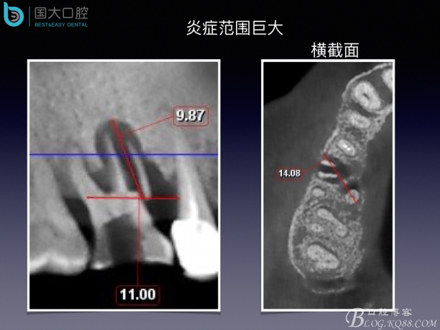 20160715154509_54779.jpeg 20160715154509_54779.jpeg