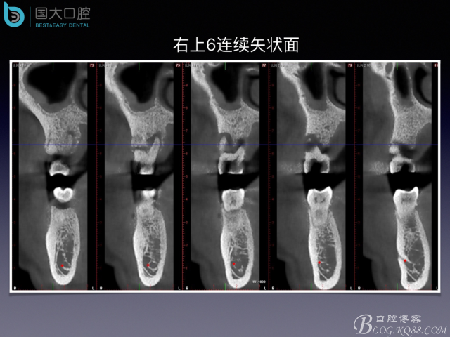 20160715154510_98019.jpeg 20160715154510_98019.jpeg