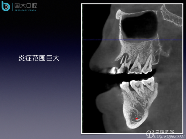 20160715154512_46913.jpeg 20160715154512_46913.jpeg