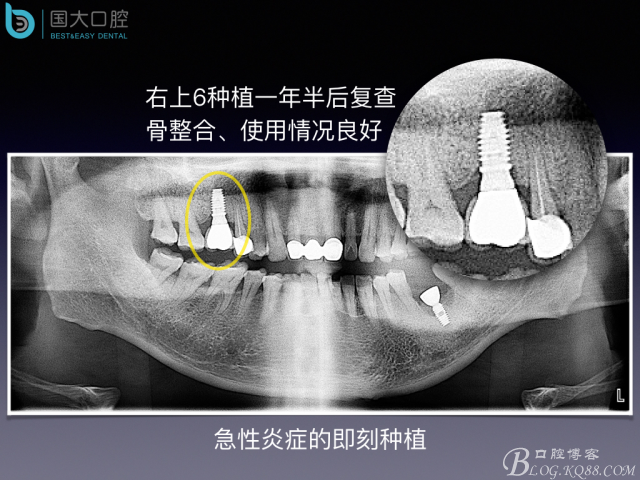 20160715154515_66288.jpeg 20160715154515_66288.jpeg