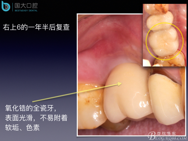 20160715154605_84549.jpeg 20160715154605_84549.jpeg