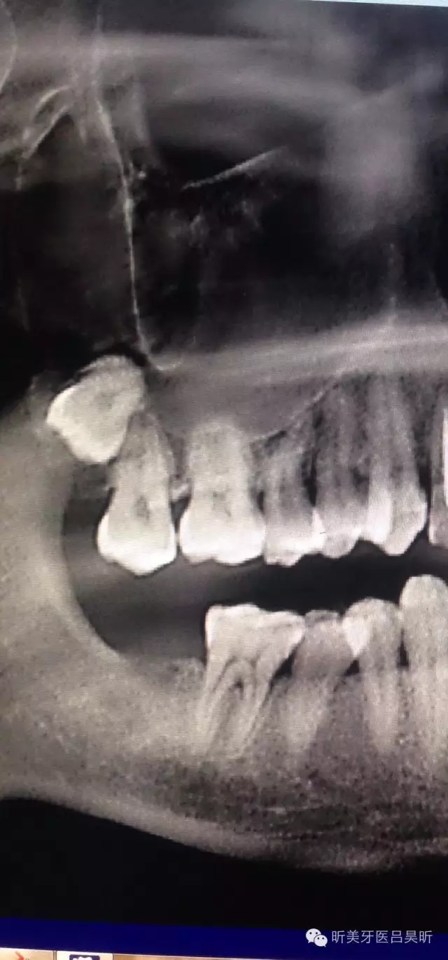 640.webp.jpg 640.webp.jpg