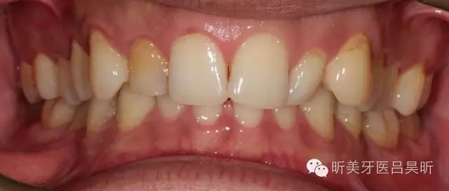 640.webp (1).jpg 640.webp (1).jpg