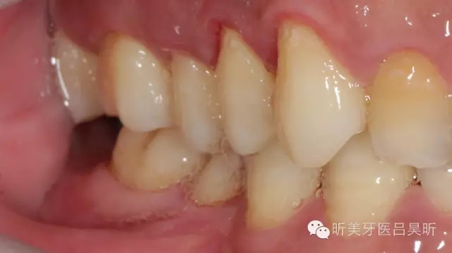 640.webp (2).jpg 640.webp (2).jpg