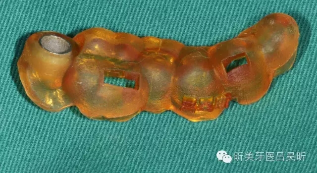 640.webp (25).jpg 640.webp (25).jpg