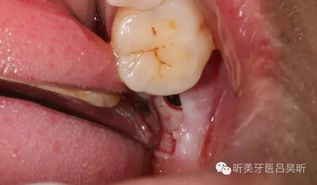 640.webp (33).jpg 640.webp (33).jpg