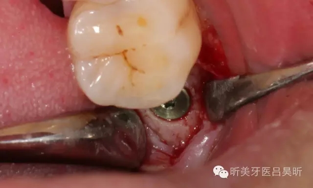 640.webp (34).jpg 640.webp (34).jpg