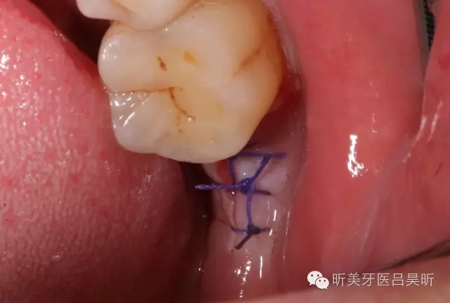 640.webp (35).jpg 640.webp (35).jpg