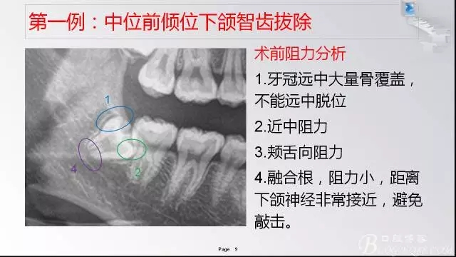 640.webp (1).jpg 640.webp (1).jpg