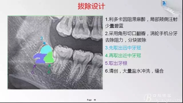 640.webp (2).jpg 640.webp (2).jpg