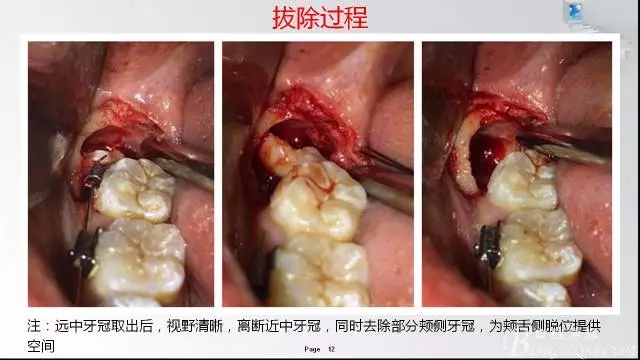 640.webp (4).jpg 640.webp (4).jpg