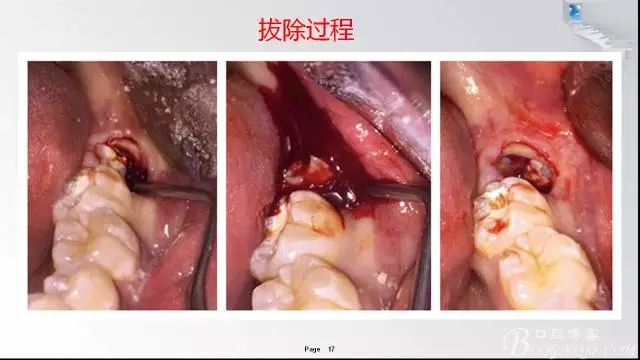 640.webp (9).jpg 640.webp (9).jpg