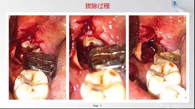 640.webp (16).jpg 640.webp (16).jpg