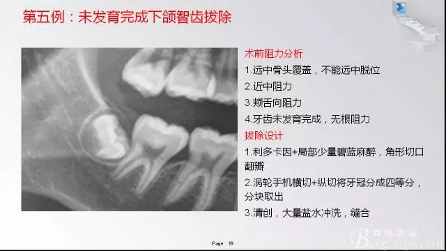 640.webp (18).jpg 640.webp (18).jpg