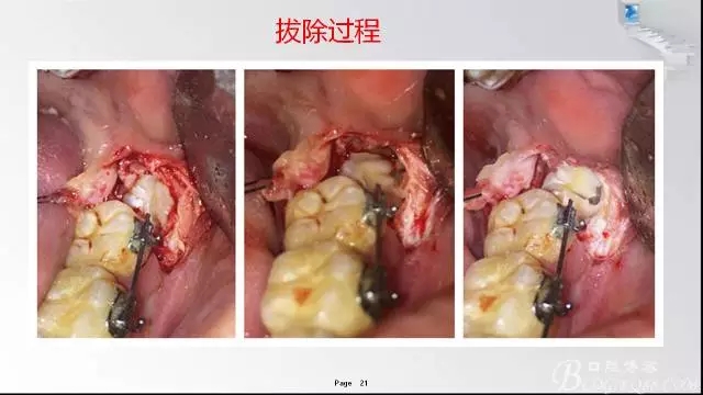 640.webp (20).jpg 640.webp (20).jpg