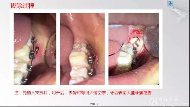 640.webp (23).jpg 640.webp (23).jpg