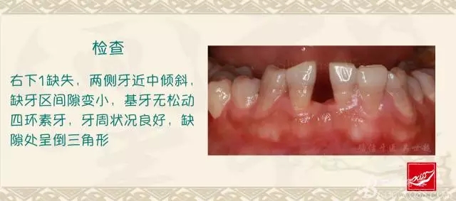 640.webp (1).jpg 640.webp (1).jpg